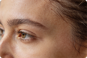 how hair graft works