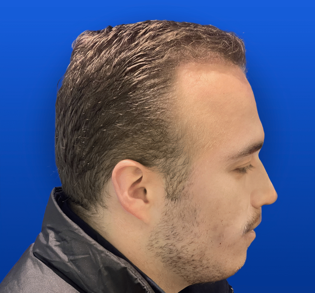 1-1 A