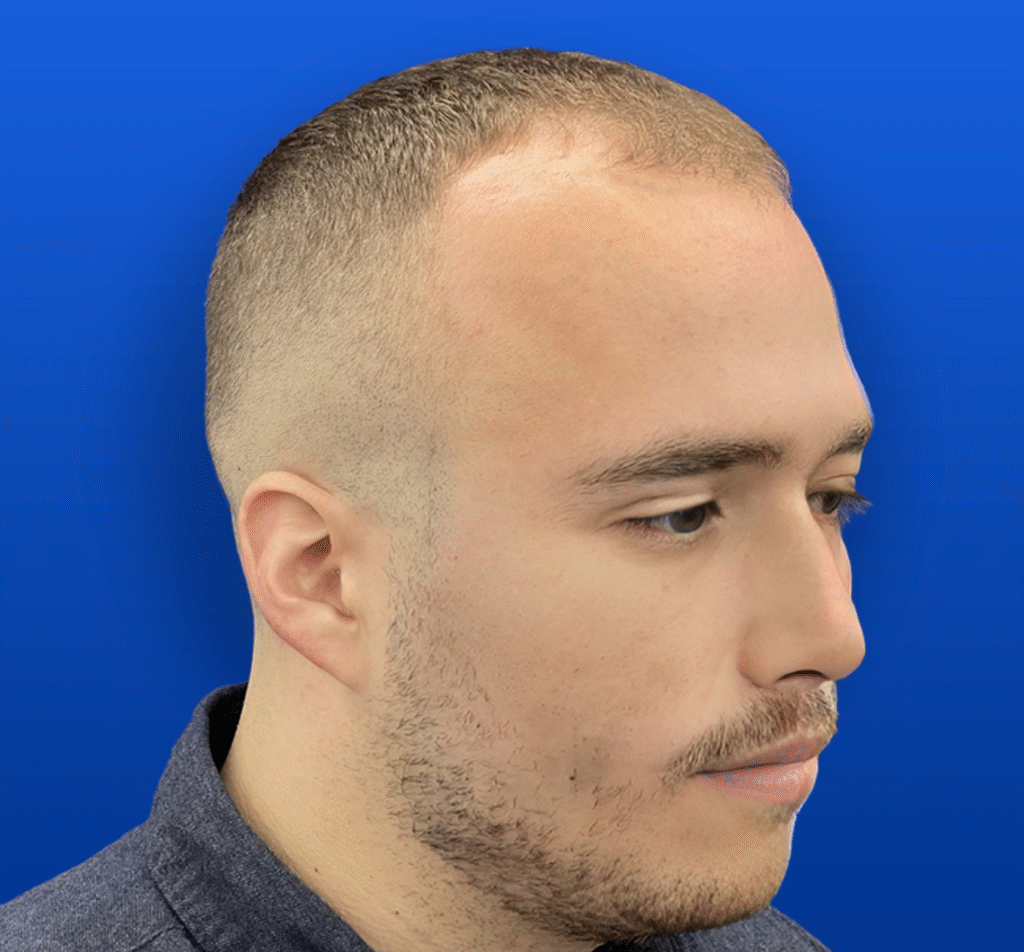 1-1 B