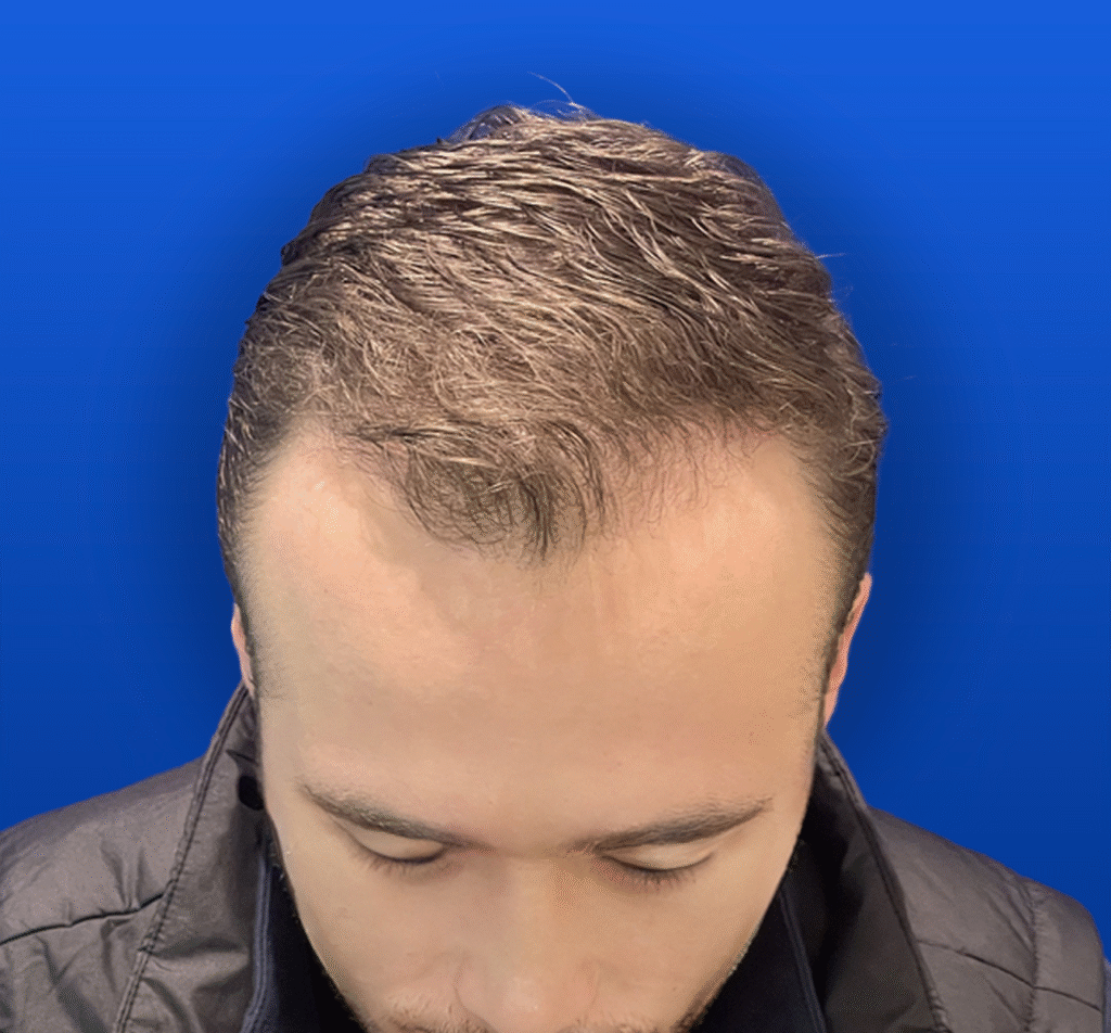 1-2 A
