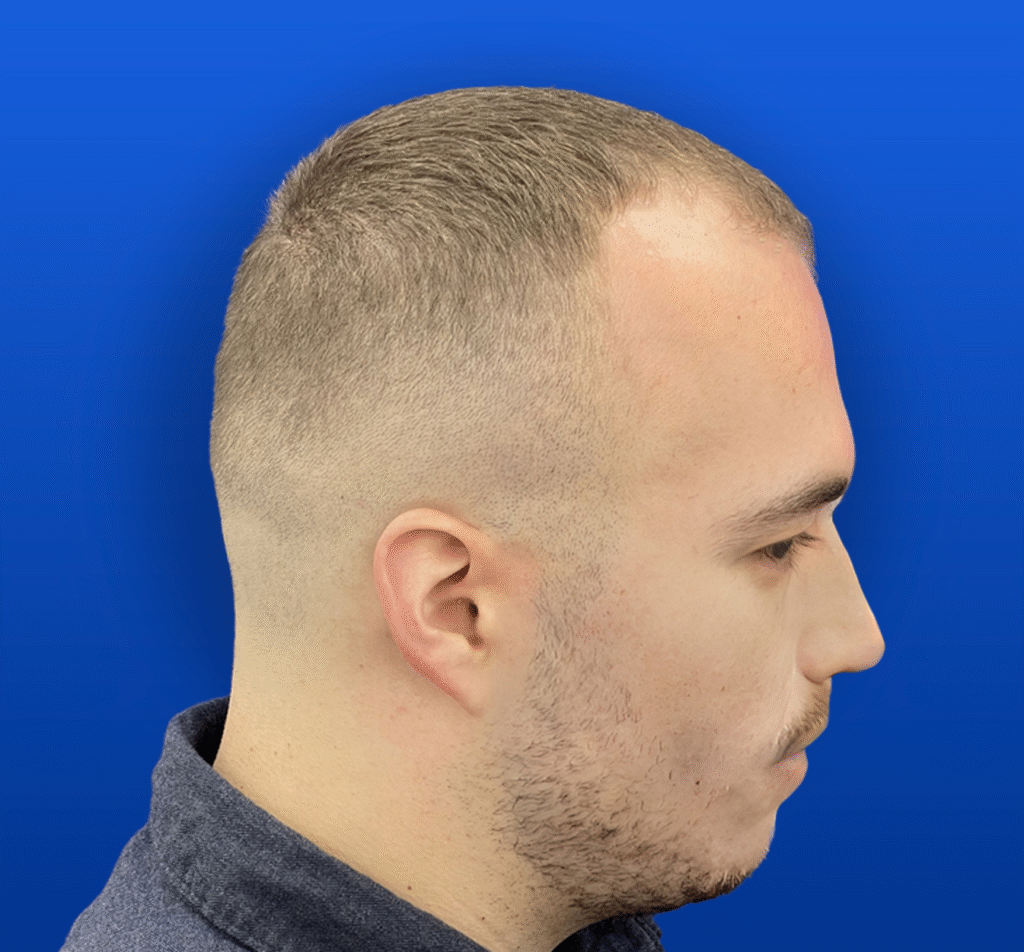 1-3 B