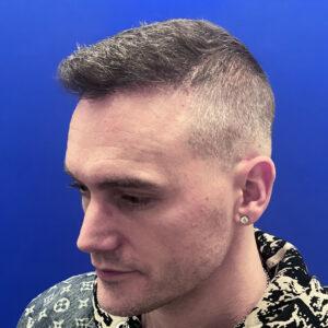 Hair Transplant Specialists | Northwestern Hair Restoration