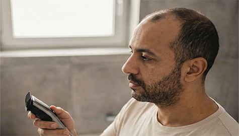 Do I Need To Shave My Head For A Hair Transplant?