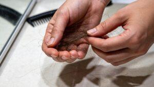 The Science Behind Hair Transplant Growth Cycles