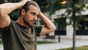 How Hairline Design Impacts The Final Result Of A Hair Transplant